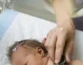 Гемолітична хвороба новонароджених Гемолітична анемія новонародженого асоційована резус фактором